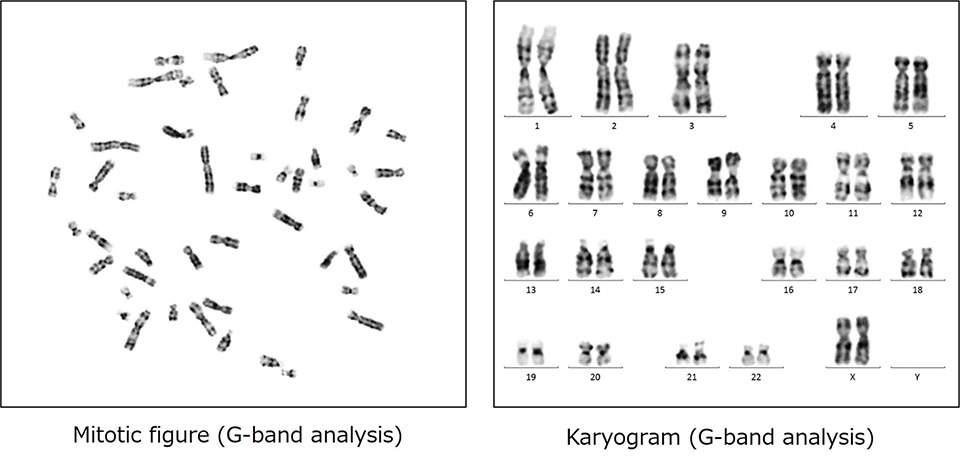Mitotic figure and karyogram of G-band analysis
