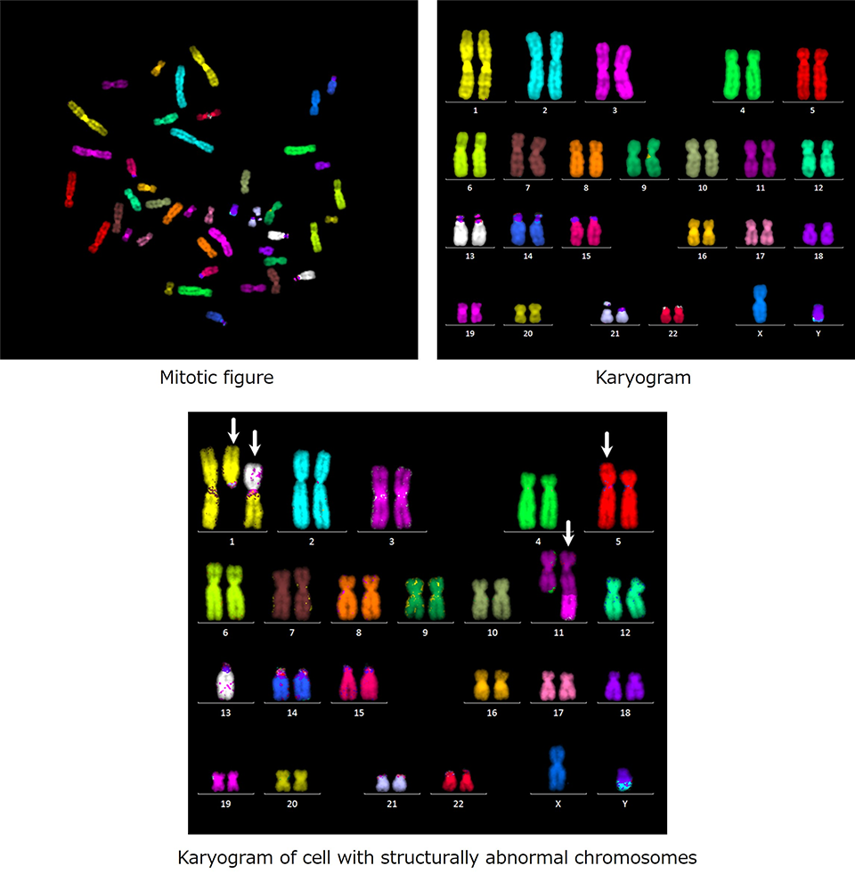 Mitotic figure and karyogram of multicolor FISH analysis