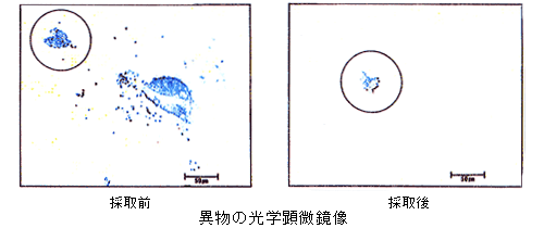 Retrieval of foreign matter with a micromanipulator system